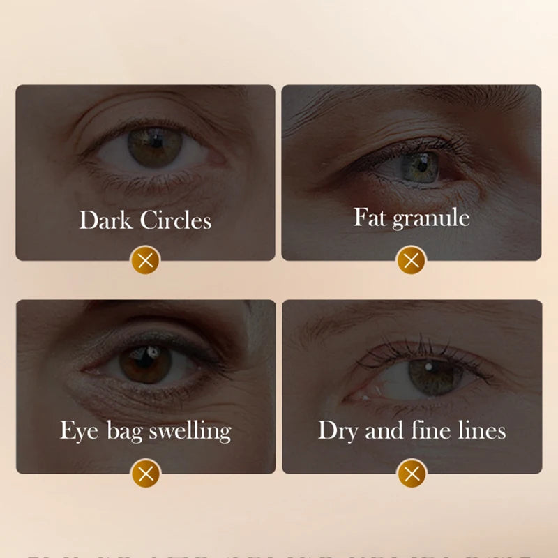 SADOER Snake Venom Eye Cream – Peptides & Caffeine for Wrinkles, Dark Circles & Hydration